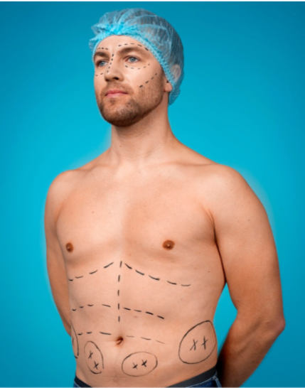 5 Reasons to Go for Sculptra Treatment After Medically Assisted Weight Loss